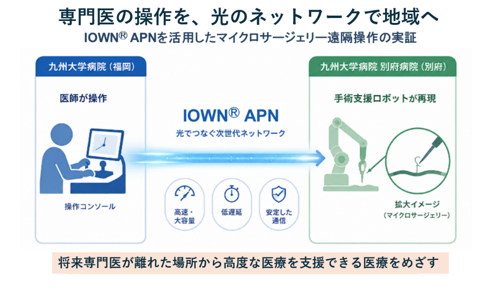 九州大学病院と九州大学病院別府病院をIOWN APNで接続する遠隔手術の概要
